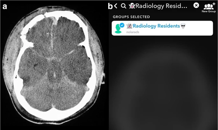 Snapchat radiology image